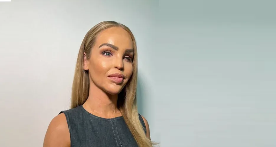 Katie Piper official speaker profile picture