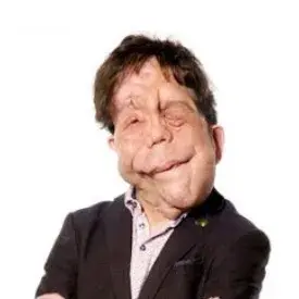 Adam Pearson