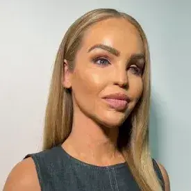 Katie Piper official speaker profile picture 