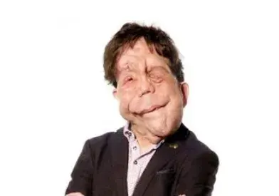 Adam Pearson